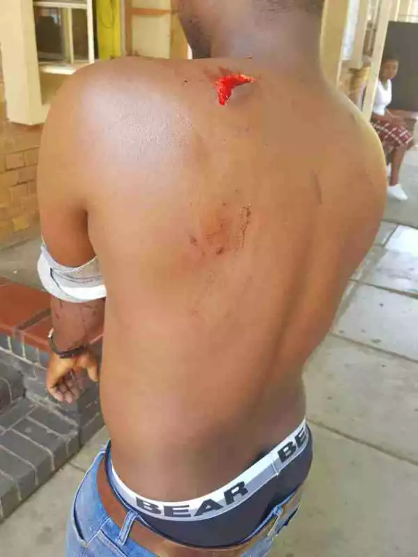 Xenophobia: Nigerian Stabbed In South Africa (Photo)